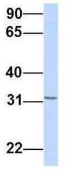 Anti-YIF1B antibody, Internal used in Western Blot (WB). GTX46602