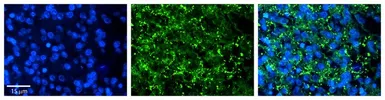 Anti-KIAA0317 antibody, N-term used in IHC (Paraffin sections) (IHC-P). GTX46608