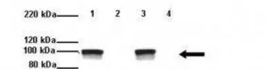 Anti-DPP6 antibody, Internal used in Western Blot (WB). GTX46611