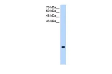 Anti-TMEM75 antibody, C-term used in Western Blot (WB). GTX46614