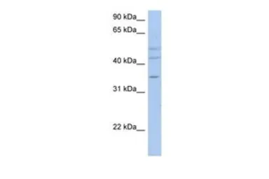 Anti-ACPL2 antibody, N-term used in Western Blot (WB). GTX46616