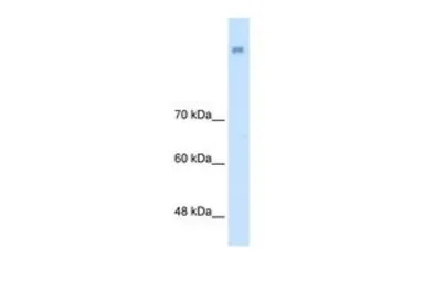 Anti-NRCAM antibody, N-term used in Western Blot (WB). GTX46617