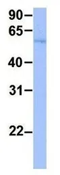 Anti-FAM134B antibody, Internal used in Western Blot (WB). GTX46622