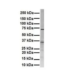 Anti-RHOT1 antibody, Internal used in Western Blot (WB). GTX46623