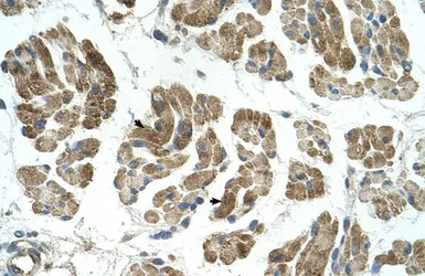 Anti-RHOT1 antibody, N-term used in IHC (Paraffin sections) (IHC-P). GTX46625