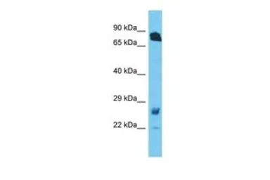 Anti-RHOT1 antibody, N-term used in Western Blot (WB). GTX46625