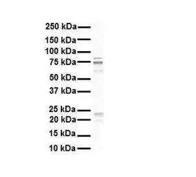 Anti-RHOT1 antibody, N-term used in Western Blot (WB). GTX46625