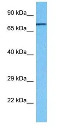 Anti-RHOT1 antibody, N-term used in Western Blot (WB). GTX46625