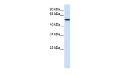 Anti-ENTPD8 antibody, N-term used in Western Blot (WB). GTX46626