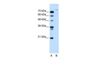 Anti-USP48 antibody, Internal used in Western Blot (WB). GTX46628