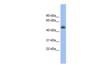Anti-HAI-1 antibody, Internal used in Western Blot (WB). GTX46629