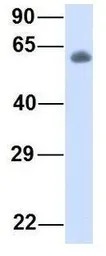 Anti-HAI-1 antibody, Internal used in Western Blot (WB). GTX46629