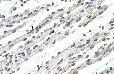 Anti-RCE1 antibody, N-term used in IHC (Paraffin sections) (IHC-P). GTX46634