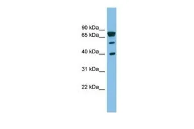 Anti-LETMD1 antibody, Internal used in Western Blot (WB). GTX46643