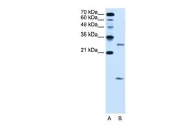 Anti-VMA21 antibody, N-term used in Western Blot (WB). GTX46647