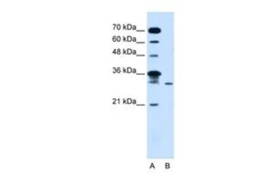 Anti-GLTPD2 antibody, Internal used in Western Blot (WB). GTX46655