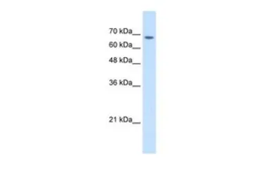 Anti-TM9SF1 antibody, Internal used in Western Blot (WB). GTX46657