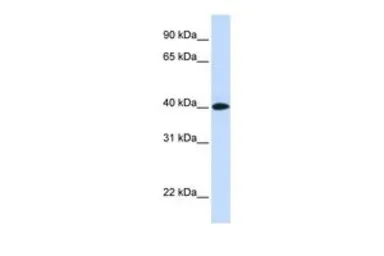 Anti-VSIG8 antibody, N-term used in Western Blot (WB). GTX46662