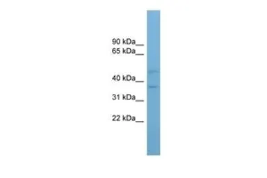Anti-AADACL4 antibody, Internal used in Western Blot (WB). GTX46665