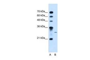 Anti-AGPAT2 antibody, C-term used in Western Blot (WB). GTX46672