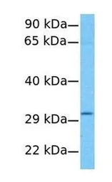 Anti-AGPAT2 antibody, C-term used in Western Blot (WB). GTX46672
