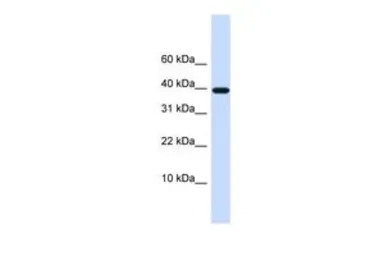 Anti-LECT1 antibody, N-term used in Western Blot (WB). GTX46674