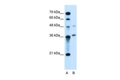 Anti-ARMCX6 antibody, N-term used in Western Blot (WB). GTX46680