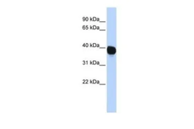Anti-TPST2 antibody, Internal used in Western Blot (WB). GTX46685