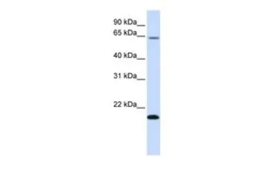 Anti-FAM19A3 antibody, Internal used in Western Blot (WB). GTX46711
