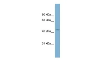 Anti-FCRL6 antibody, Internal used in Western Blot (WB). GTX46716