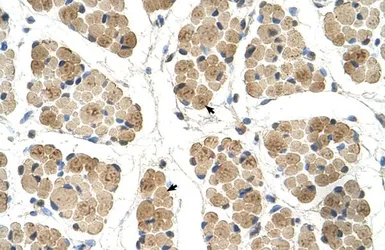 Anti-KLHL31 antibody, C-term used in IHC (Paraffin sections) (IHC-P). GTX46719