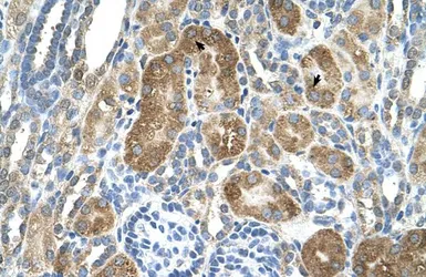 Anti-C6ORF21 antibody, N-term used in IHC (Paraffin sections) (IHC-P). GTX46721