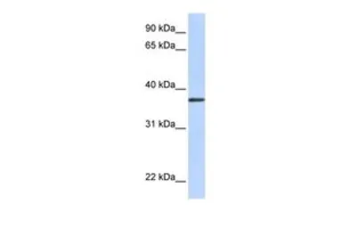 Anti-TTMB antibody, N-term used in Western Blot (WB). GTX46722