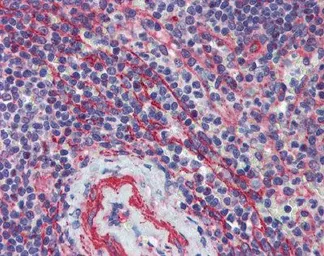 Anti-MCTP1 antibody, Internal used in IHC (Paraffin sections) (IHC-P). GTX46724