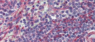 Anti-MCTP1 antibody, Internal used in IHC (Paraffin sections) (IHC-P). GTX46724