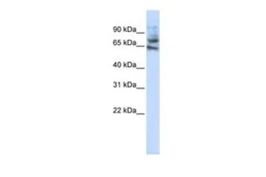 Anti-MCTP1 antibody, Internal used in Western Blot (WB). GTX46725