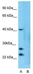 Anti-LYCAT antibody, Internal used in Western Blot (WB). GTX46729