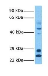 Anti-LYCAT antibody, Internal used in Western Blot (WB). GTX46729