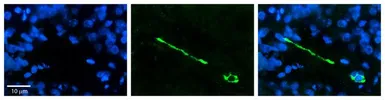 Anti-MTUS1 antibody, Internal used in IHC (Paraffin sections) (IHC-P). GTX46731