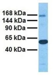 Anti-MTUS1 antibody, Internal used in Western Blot (WB). GTX46731