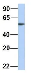 Anti-MTUS1 antibody, Internal used in Western Blot (WB). GTX46731