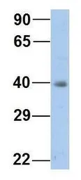 Anti-MTUS1 antibody, Internal used in Western Blot (WB). GTX46731