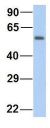 Anti-MTUS1 antibody, Internal used in Western Blot (WB). GTX46731
