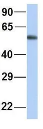 Anti-MTUS1 antibody, Internal used in Western Blot (WB). GTX46731