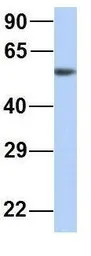 Anti-MTUS1 antibody, Internal used in Western Blot (WB). GTX46731