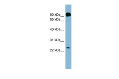 Anti-PRRG1 antibody, N-term used in Western Blot (WB). GTX46741