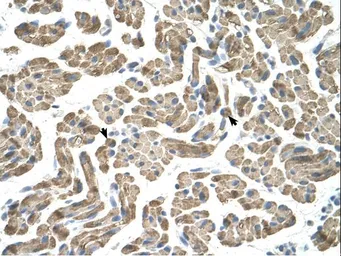 Anti-NEU1 antibody, Internal used in IHC (Paraffin sections) (IHC-P). GTX46743