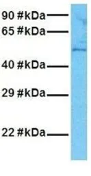 Anti-NEU1 antibody, Internal used in Western Blot (WB). GTX46743