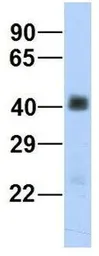 Anti-beta Sarcoglycan antibody, Internal used in Western Blot (WB). GTX46747
