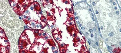 Anti-G6PC antibody, N-term used in IHC (Paraffin sections) (IHC-P). GTX46748